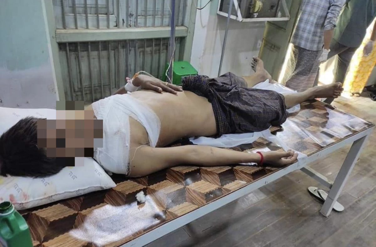 shafiur's tweet photo. #March3Coup MyinGyan. Deadly attacks and use of live ammunition continues against unarmed civilians. Two people reported critical today.  10 shot. 

#WhatsHappeninglnMyanmar #myanmar https://t.co/hYNt3qAHv9