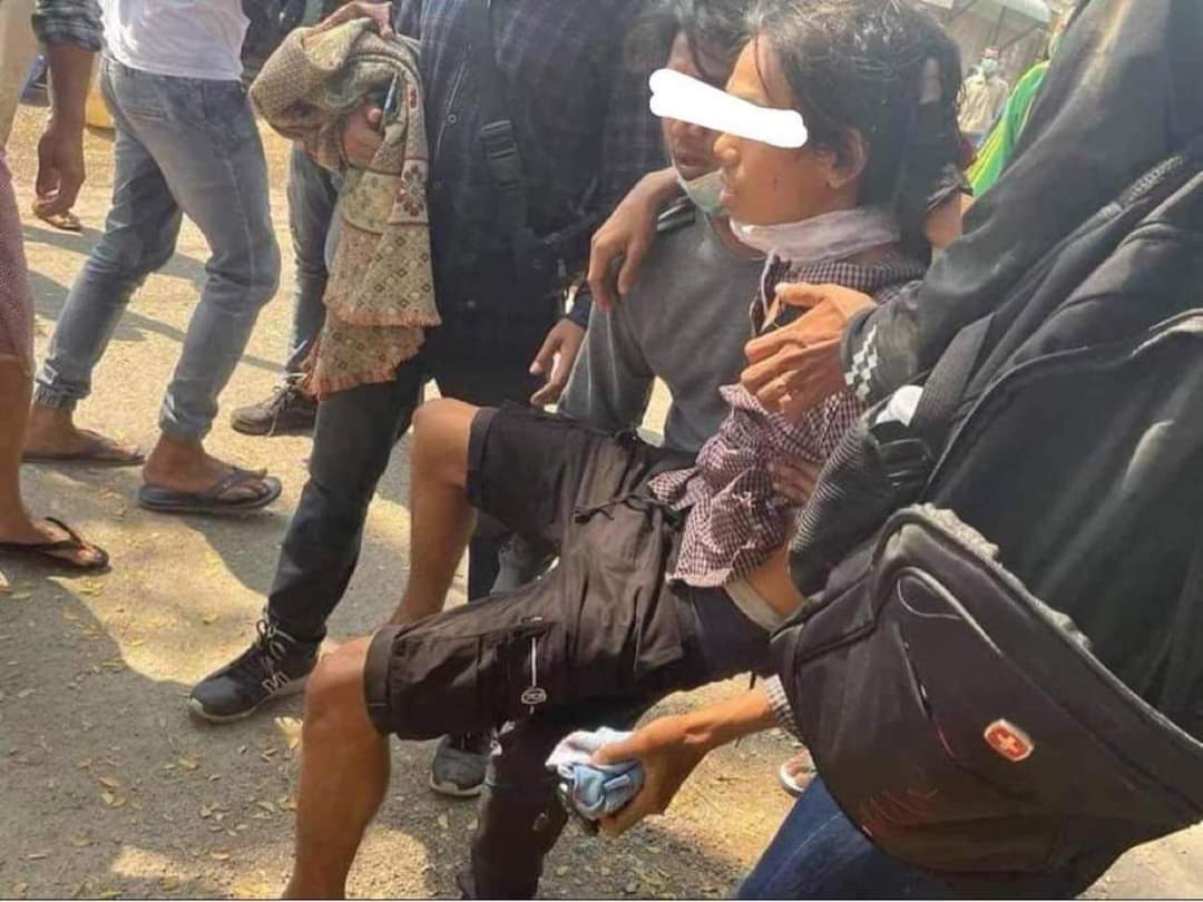 Tw // blood
There are many victims in MonywaIt is reported that 2 people have died in Monywa protest 
#WhatsHappeninglnMyanmar 
#Mar3Coup <a href="/freya_cole/">Freya Cole</a>