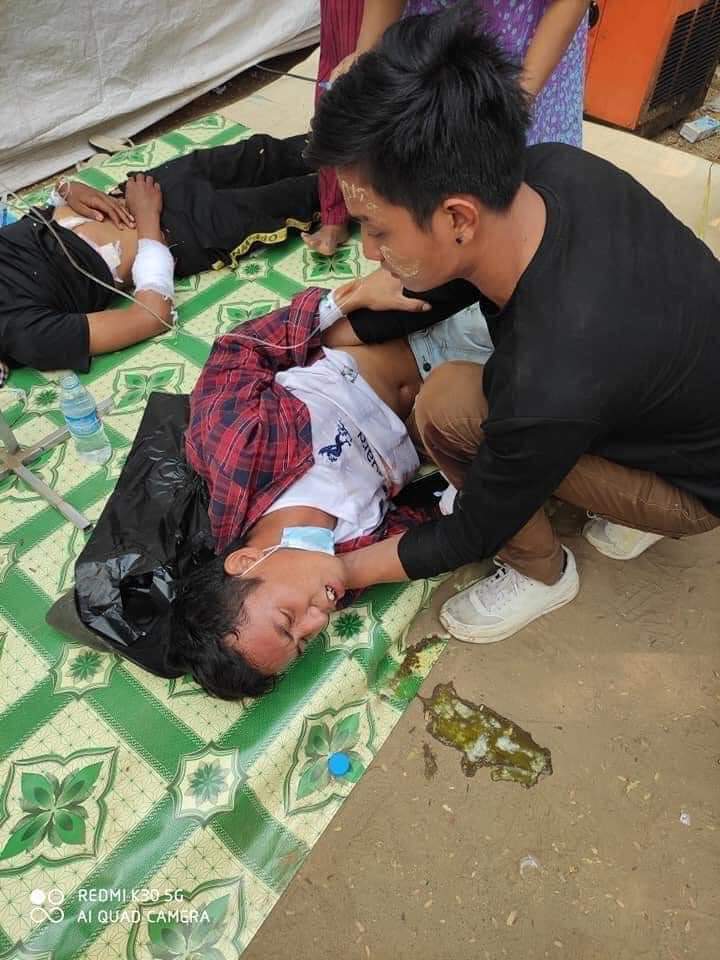 KoKyushi's tweet photo. Happening now in Myingyan,Myanmar.Bloody crack-down on march against Military Regime in Mandalay division on Mar 3. At least 9 were critically injured due to gunshot wounds.They use live ammunition in every protest break up.
JUSTICE FOR MYANMAR 
#Mar3Coup
#WhatsHappeningInMyanmar https://t.co/1llNw4CUnd