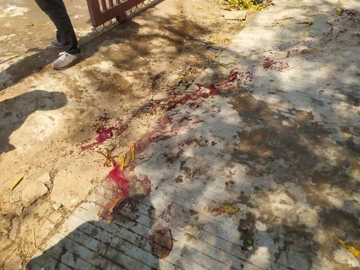Tw//Blood

Happening Now🚨
About 7 was shot with live ammunition in Monywa.

JUSTICE FOR MYANMAR

<a href="/freya_cole/">Freya Cole</a> 
<a href="/UN/">United Nations</a> 
@MayWongCNA 
<a href="/RapporteurUn/">UN Special Rapporteur Tom Andrews</a> 
<a href="/drsasa_mm/">Dr.Sasa-Supporter</a>
#WhatsHappeningInMyanmar 
#March3Coup
