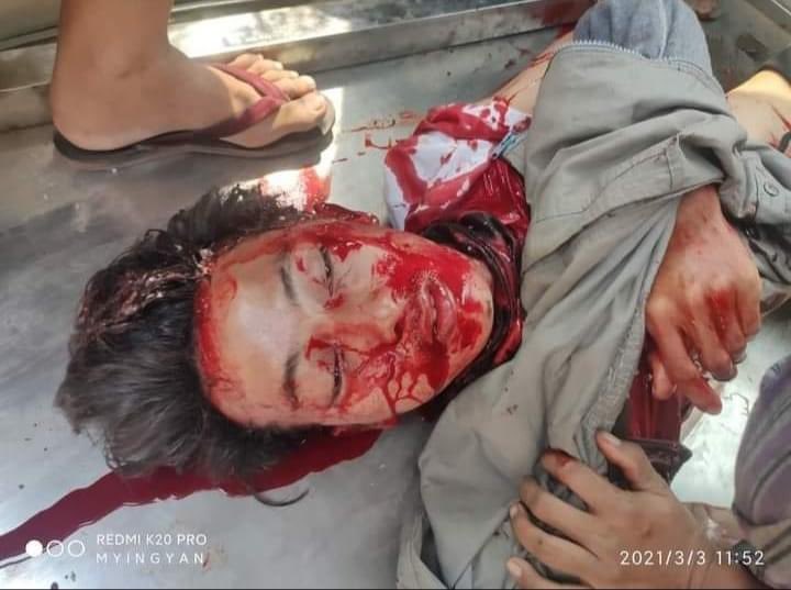 hannah_chaw's tweet photo. ‼️Happening now in Myingyan (11:58 am)‼️
Tdy in Myingyan, terrorists shot with real bullets &amp;  a 14 years old young boy died at the spot because of headshot. 
TW// blood , dead 
#WhatsHappeningInMyanmar
#Mar3Coup https://t.co/ACs90gEKqY