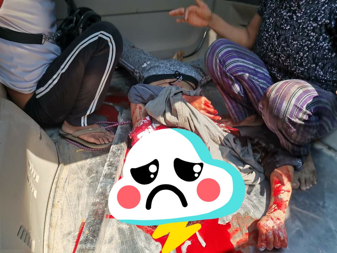 Today In Myin Gyan
Juntas shoot 14 years old boy by headshot. 
 tw//blood/wounds
#WhatsHappeningInMyanmar 
#Mar3Coup