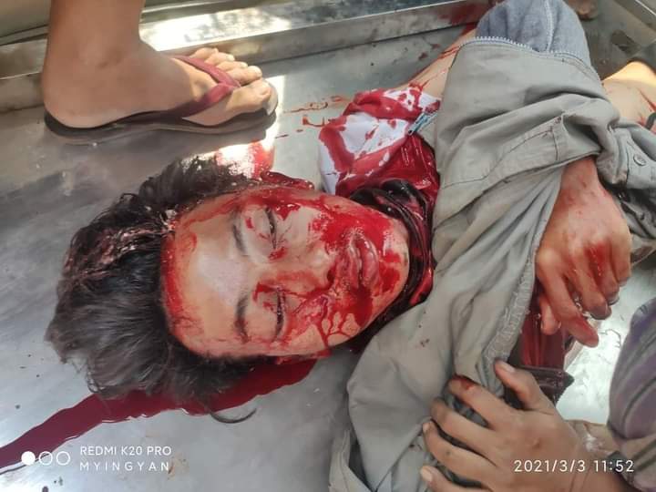 KoKyushi's tweet photo. @Juarawee Criminal Min Aung Hlaing’s confederates killed a teenager in Myingyan. He is only 14 and shot in head dead on march 3. Isn’t Fatal shooting a crime, then what? We need serious action to halt their inhuman killing.
TW// blood
JUSTICE FOR MYANMAR 
#Mar3Coup
#WhatsHappeningInMyanmar https://t.co/N1J1Cv0agw