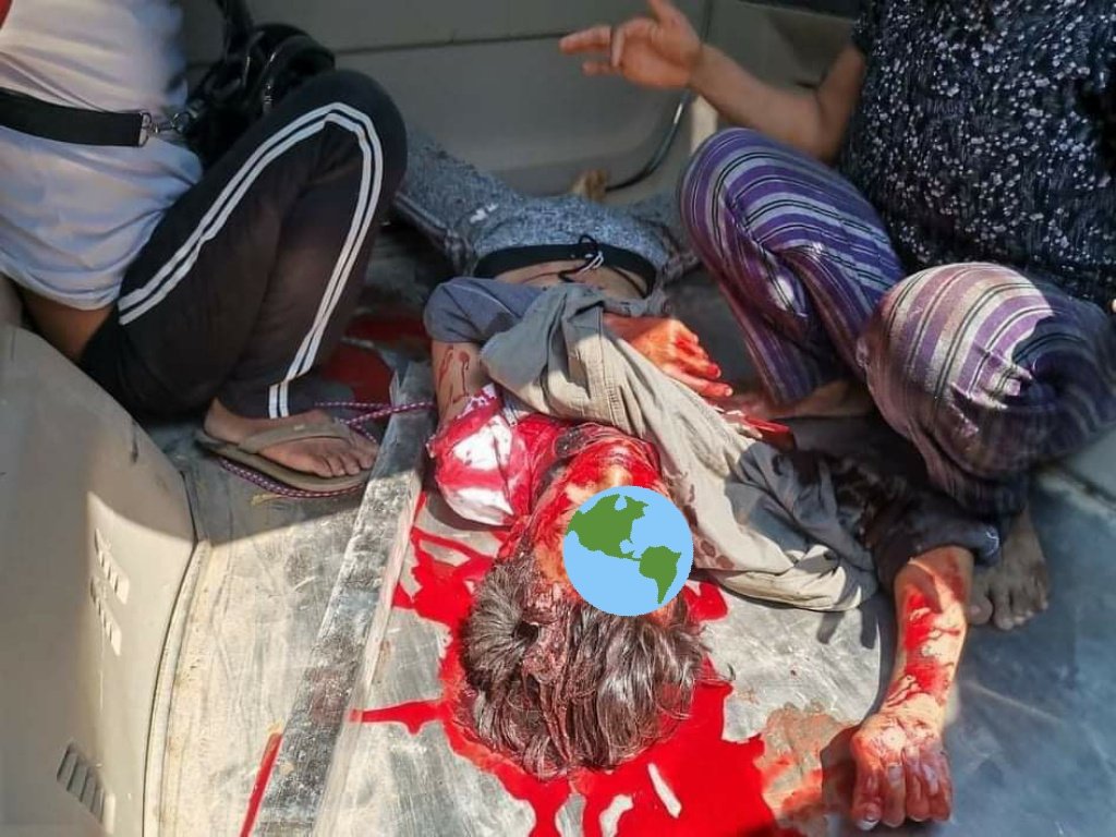 TW // Death Military cracked the protesting crowd down in #Myingyan. A 14-year-old had been head shot to death. <a href="/UN/">United Nations</a> how many lives need to sacrifice to save us from this military’s brutality?#WhatsHappeningInMyanmar #March3Coup <a href="/RapporteurUn/">UN Special Rapporteur Tom Andrews</a> <a href="/YourAnonCentral/">Anonymous</a> <a href="/POTUS/">President Donald J. Trump</a>