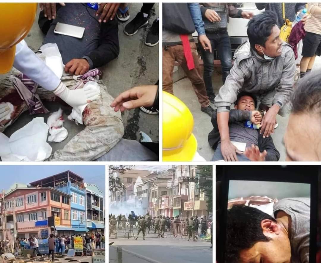 Soohanbin23678's tweet photo. Tw//blood 
At MyinChan, Myanmar: 19 years old boy dead by headshot. at lest 9 civilians injured by real bullet

 @UN_HRC @hrw  @UN @NATO @KenRoth @RapporteurUn @freya_cole

JUSTICE FOR MYANMAR

#Mar3Coup
#WhatsHappeningInMyanmar https://t.co/2jXmNShrv0
