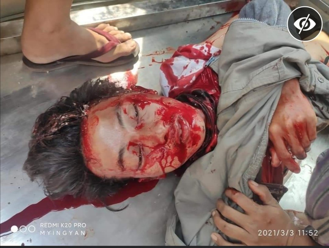 Soohanbin23678's tweet photo. Tw//blood 
At MyinChan, Myanmar: 19 years old boy dead by headshot. at lest 9 civilians injured by real bullet

 @UN_HRC @hrw  @UN @NATO @KenRoth @RapporteurUn @freya_cole

JUSTICE FOR MYANMAR

#Mar3Coup
#WhatsHappeningInMyanmar https://t.co/2jXmNShrv0