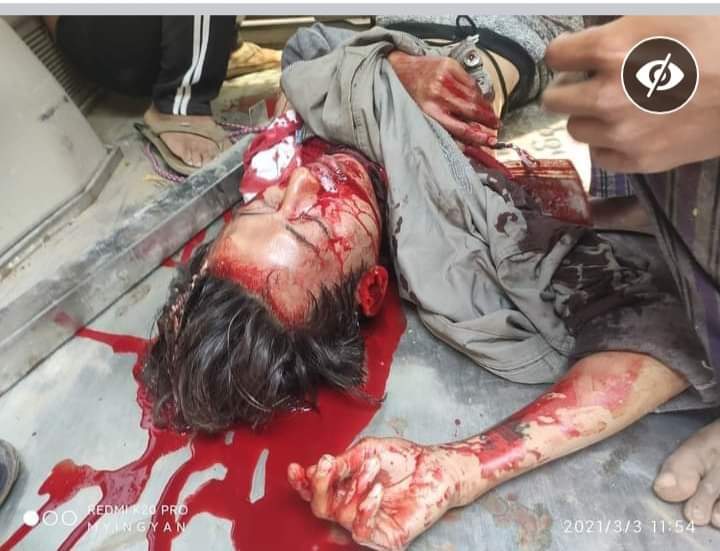 RazzaShwe's tweet photo. Can no one help with the violence in Burma?

#PleaseHelpMyanmarPeople https://t.co/H0ltcfa6d3