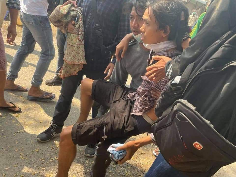 TW//Blood, Wounded 
JUSTICE FOR MYANMAR
#Monywa today - 4 were reportedly dead.
#Mar3Coup
#WhatsHappeningInMyanmar