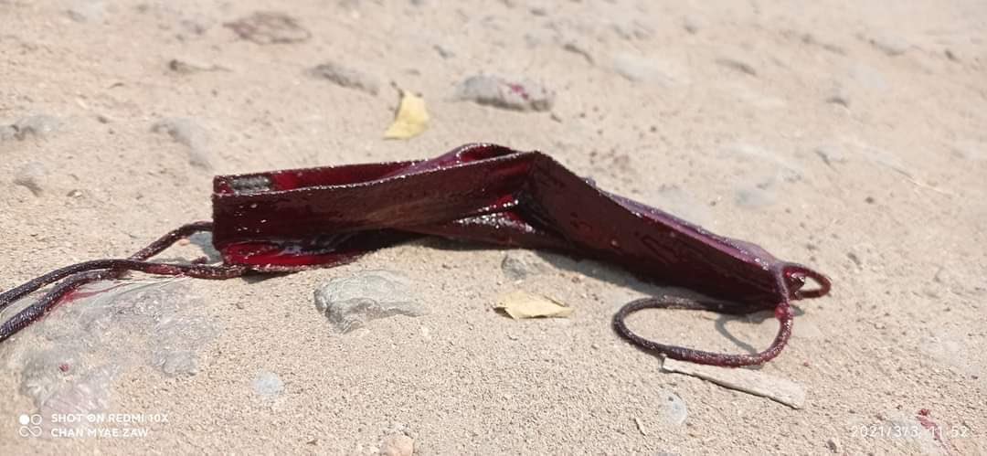 khin_kt's tweet photo. TW: Gunshot,death. Today Myanmar (Myin gyan). One died who is just 25yrs old and several people injured. We don't deserve such kind of terrorizing by Myanmar military and polices. Save us. #WhatsHappeningInMyanmar #Mar3Coup https://t.co/E8bgaHgM0X