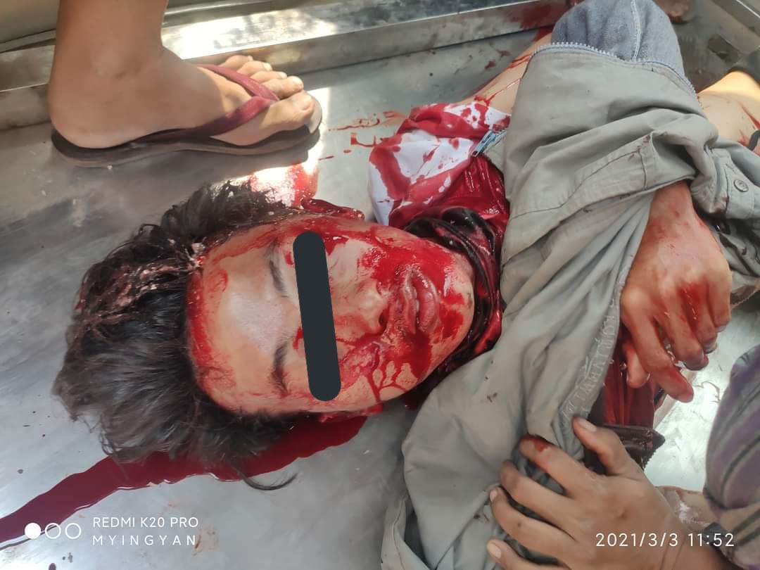 Kookie___K_'s tweet photo. TW// Blood, Gross content
Why @ASEAN is taking the side of TERRORIST and MURDERERS? 😡
#WhatsHappeningInMyanmar 
#ASEANRespectOurVotes 
#rejectASEANresolution
@YourAnonCentral @KenRoth https://t.co/buRUlpjiY5