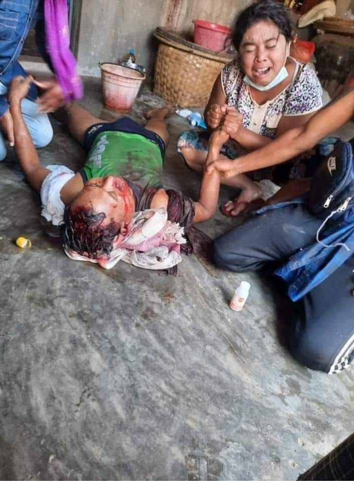 TW : BLOOD, SEVERE INJURY
The military violently crackdown anti-coup protesters by using live bullets in Monywa.
At least 7 people were severely  injured, 4 people died including headshot injury.

TERRORIST JUNTA
JUSTICE FOR MYANMAR

#WhatsHappeningInMyanmar
#Mar3Coup
