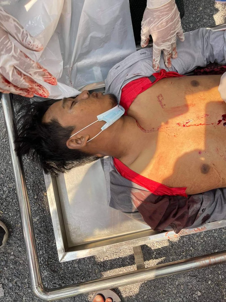 Now In Mandalay,
One man and lady shoot Juntas by real bullet and die now.
tw//blood/wounds
#WhatsHappeningInMyanmar 
#Mar3Coup