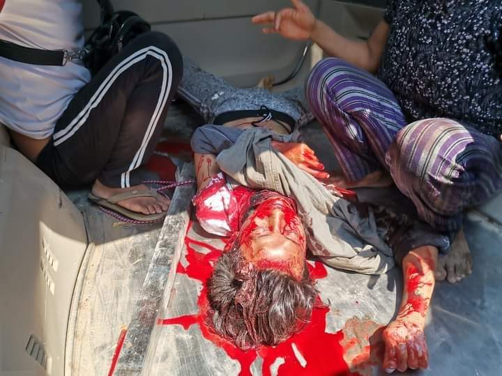 At 11:59 a.m. Myanmar Standard Time At 11:59AM
Myingyan Township;
Mandalay;Myanmar
A 14-year-old boy was shot in the head with a shotgun
#WhatsHappeningInMyanmar 
#SaveMyammar 
#SaveMyanmarchildren