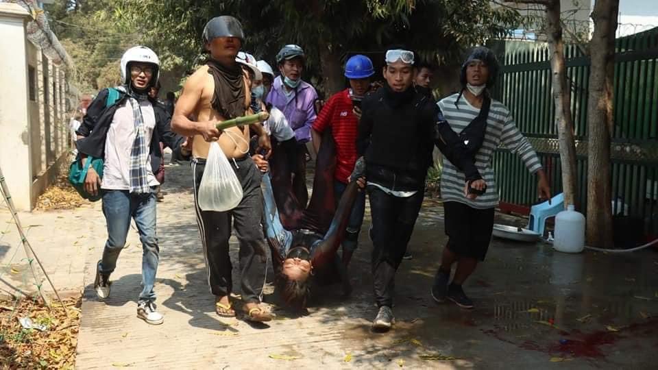 tw // gunshot, blood , violence 

We can’t miss &amp; have to cover for minor cities as violent crackdowns and gunshots injuries are happening there as well. There’s reported to be critical gunshot injuries. #WhatsHappeningInMyanmar #Mar3Coup