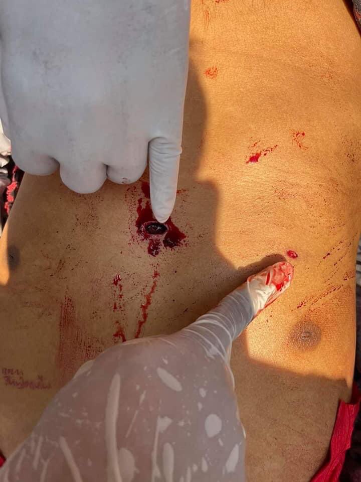 TW//Blood, Gunshot, Death, Violence

BREAKING :2 people shot dead in Mandalay
1 Male (shot in chest) &amp; 19-year-old girl (shot in head)died on the spot after violent attack by terrorist forces in an attempt to disperse the protest in Mandalay
#WhatsHappeningInMyanmar