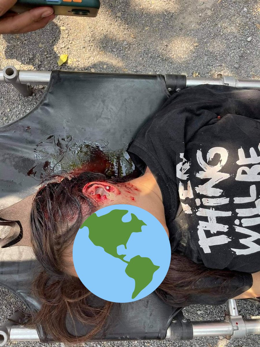 Zad71501902's tweet photo. @freya_cole @ahkgo She is only 19 years old ...but junta killed as enemy https://t.co/xQP3q7TNbJ