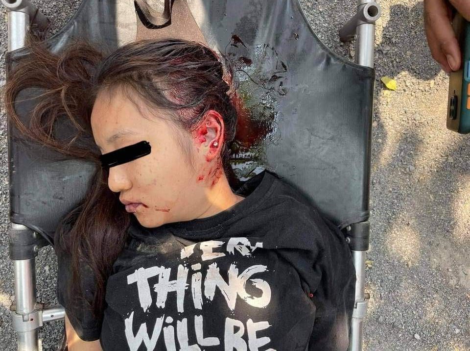 Little_winnie_'s tweet photo. tw: blood, dead body
Location: Mandalay , Myanmar
A 19-year-old girl was shot to death (head shot) today by the inhuman Junta. She was the only child for her parents.
NO ONE IS PROTECTING US! 
@freya_cole @YourAnonCentral @KenRoth @RapporteurUn
#WhatsHappeningInMyanmar 
#Mar3Coup https://t.co/JYuspafutB