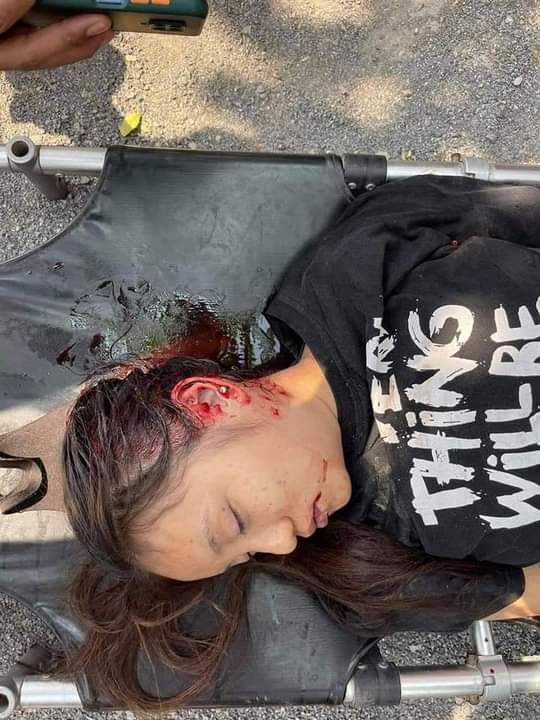 KyalEain's tweet photo. In 2021, history will show that soldiers and police are not the only ones defending the country.
#Mar3Coup
#WhatHappeningInMyanmar https://t.co/nGy6pVcFAH