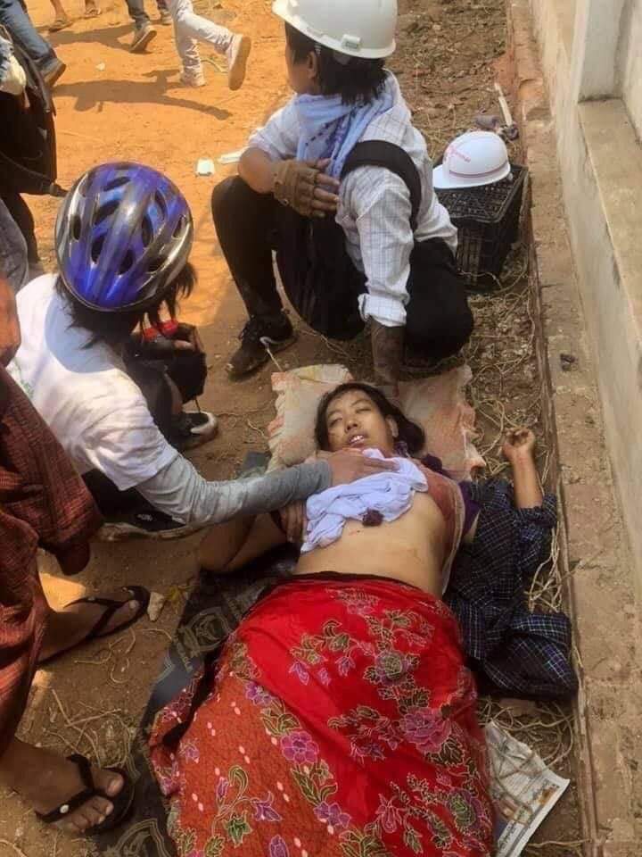 Cho20301's tweet photo. Tearful words written on the hand of fallen protester in Monywa was her last wish which is to donate her dead body to needed person if she died during DEMOCRACY Fight! 

TW// blood
JUSTICE FOR MYANMAR 

#Mar3Coup
#WhatsHappeningInMyanmar https://t.co/iuKhBtHmWU