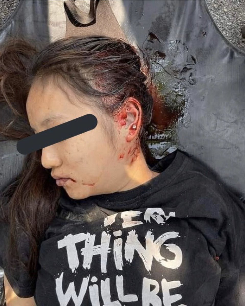 One of our heroes passed away today. She was only 19. <a href="/UNHumanRights/">UN Human Rights</a> <a href="/OHCHRAsia/">UN Human Rights Asia</a> <a href="/TostevinM/">Matthew Tostevin</a> <a href="/freya_cole/">Freya Cole</a> #WhatsHapppeningInMyanmar #March3Coup #CrimeAgainstHumanity