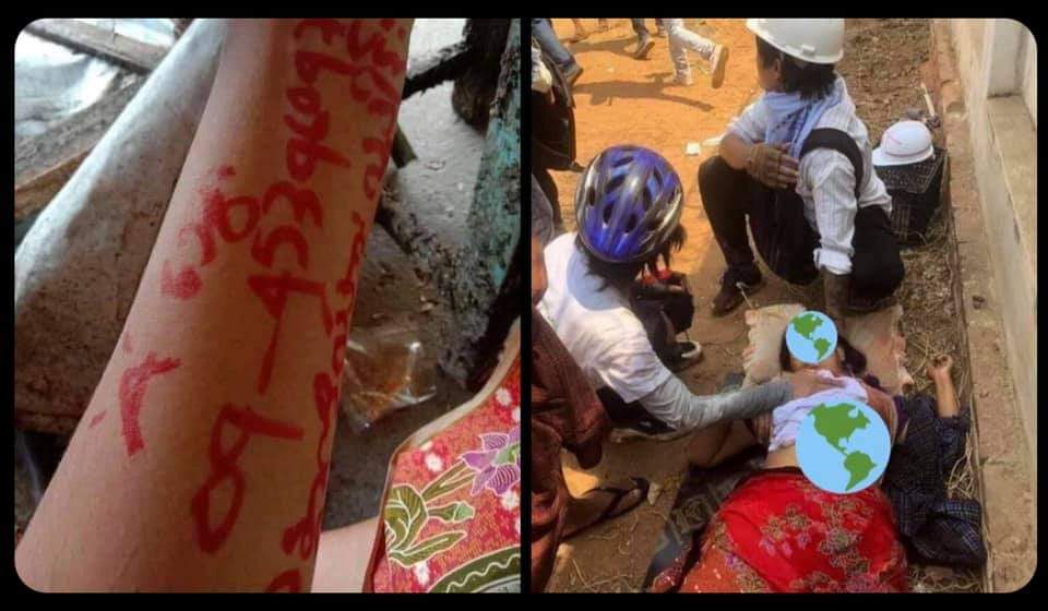 Tearful words written on the hand of fallen protester in Monywa was her last wish which is to donate her dead body to needed person if she died during DEMOCRACY Fight! 

TW// blood
JUSTICE FOR MYANMAR 

#Mar3Coup
#WhatsHappeningInMyanmar