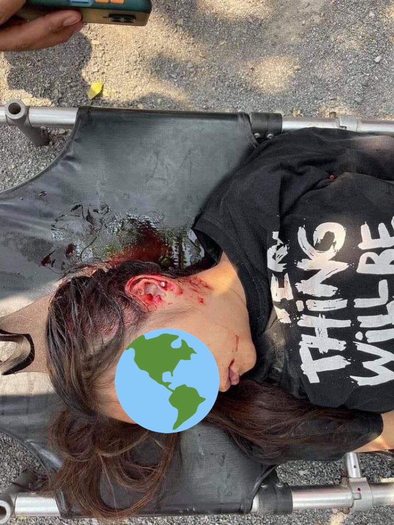 TW//dead
The brave girl who got headshot &amp; died on spot is only 19yrs old &amp; one of the frontliners.Dear World,how many of our children have to sacrifice in every given minutes?😭💔

#WhatsHappeningInMyanmar
#Mar3Coup