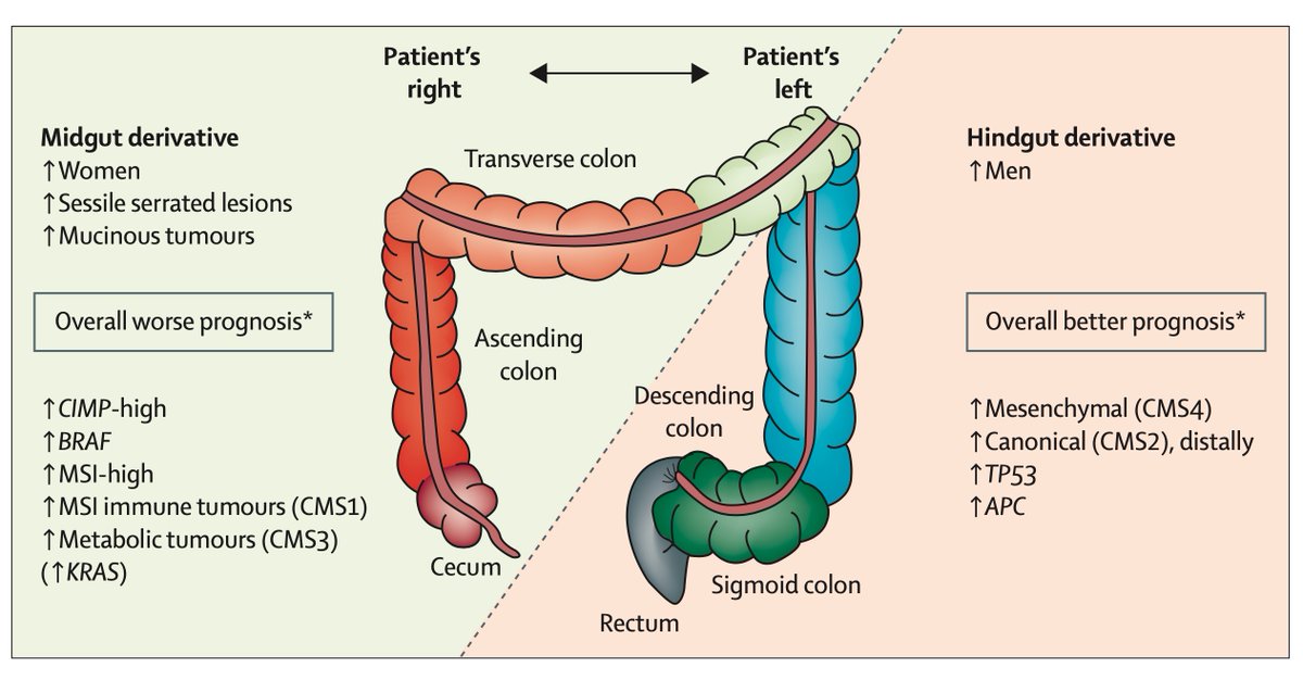 A must read review on colorectal cancer in @TheLancet @mikewallacemd 1) Incidence 📊 2) Risk factors ⚠️ 3) Why colorectal cancers develop 🧬 4) Differences between left and right sided cancers 🎯 #ColorectalCancerAwarenessMonth sciencedirect.com/science/articl…