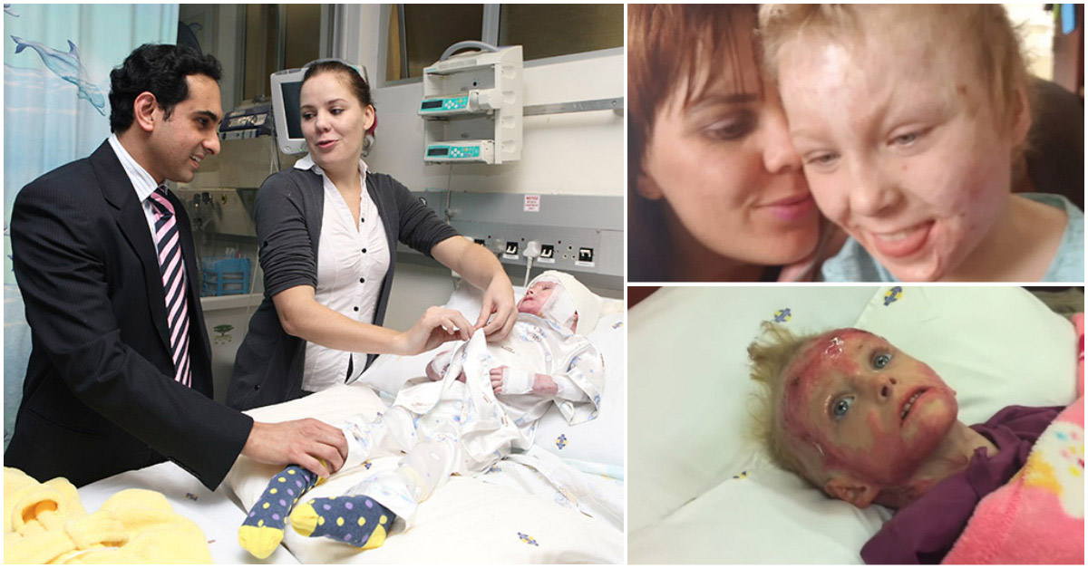 huisgenoot's tweet photo. Kleine #Pippie nou ’n tiener! Sy het onlangs herenig met dr. Mia vir prosedure https://t.co/jroVZ6qGYL https://t.co/7chsTCtGf8