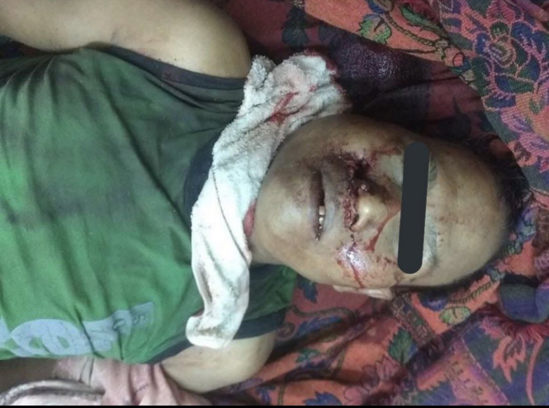 KWWOFFICIAL's tweet photo. tw // blood , dead

In Monywa, 4 unarmed protestors cruelly killed by terrorists and number of dead can be increase by time. At least 10 people injured including 2/3 people are in EMERGENCY. 

Source: The Irrawaddy

#WhatsHappeningInMyanmar #Mar3Coup https://t.co/K9LgFrLHzs