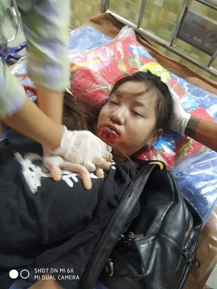 HninnWai6's tweet photo. Today, a young girl who is 19 years old was expired being headshot by Myanmar soldiers in Mandalay.Please stop crime against humanity. #MilkTeaAllianceMyanmar #AgainstMyanmarMilitaryCoup #Mar3Coup #WhatsHapppeningInMyanmar https://t.co/oHFCYDoo4Y