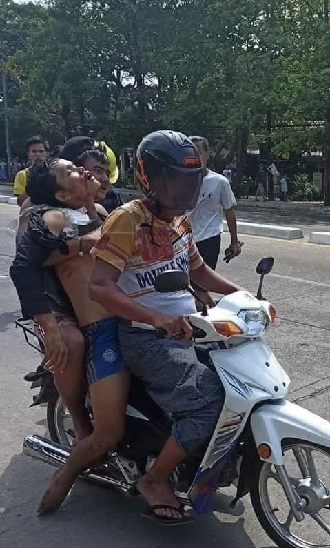 TW//Blood,Gunshots
One man shot by Gun in 
North Dagon ,Yangon ,Myanmar  

<a href="/YourAnonCentral/">Anonymous</a> 

 #WhatsHappeningInMyanmar
#Mar3Coup
