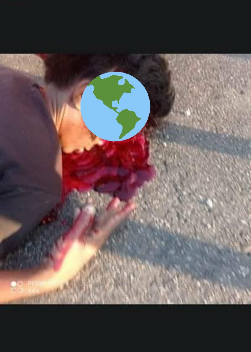 YanonePhue's tweet photo. TW : violence , gunshots , bloods , dead
Burmese junta fires machine guns in North Okkalapa, Yangon.
Twelve people were injured and one was shot in the head. The machine guns are still being fired non-stop. 

JUSTICE FOR MYANMAR
#WhatsHappeningInMyanmar
#Mar3Coup https://t.co/KjIOiNlhDv