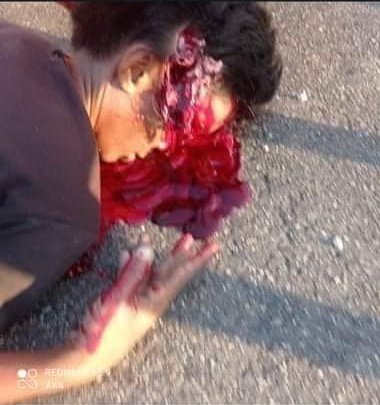 TW: gunshots
The current situation of north Oakkalarpa is very bad.There are about 40 people get injured. We need help. The person in the picture who was shot by guns(headshot). We need help. Pls help north Oakkalarpa. They need medical rescue 
#WhatsHappeningInMyanmar 
#Mar3Coup