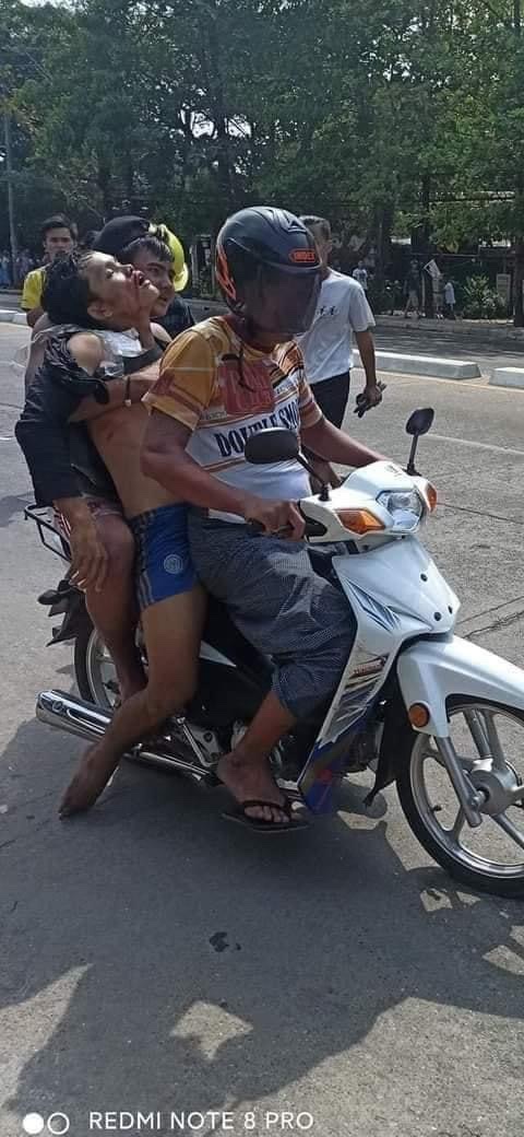 He is not a protester but a service- worker who carry and distribute water bottles to residents. He got gun shots during working in North-Okkalapa (Yangon).

When will end this kind of murder and violence ?
#WhatsHappeningInMyanmar 
#Mar3Coup