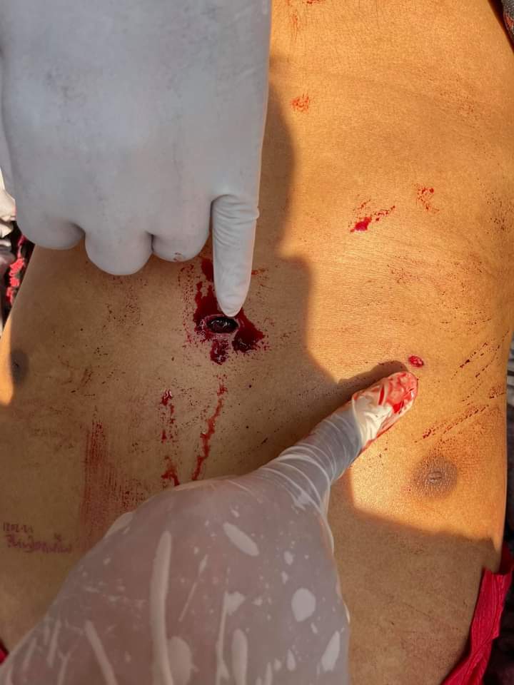 tw//gunshot and bleeding
Today in Mandalay, an average aged man was died of the gunshot by the police on the spot. How many dead bodies needed for UN to take the action? 
JUSTICE FOR MYANMAR
#Mar3Coup
#WhatsHappeningInMyanmar