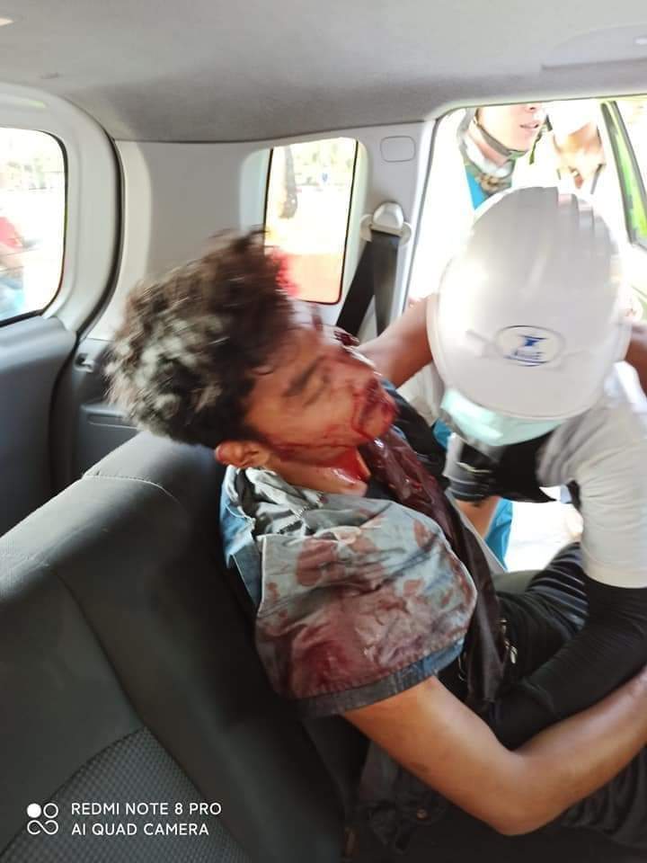 Tw // blood, wounds

In North Okkalapa, Yangon, many people were injured when the junta fired machine guns non-stop this evening.

<a href="/UN/">United Nations</a> This is not civil war. Myanmar junta's violently shooting the innocent civilians!

JUSTICE FOR MYANMAR
#WhatsHappeningInMyanmar
#Mar3Coup