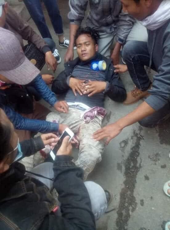 Happening now in Pyinoolwin; Min Aung Hlaing’s Armed Rebels blocked the roads and opened fire on protesters. One was shot with live ammunition and situation getting worse there. 

JUSTICE FOR MYANMAR 

#Mar3Coup
#WhatsHappeningInMyanmar