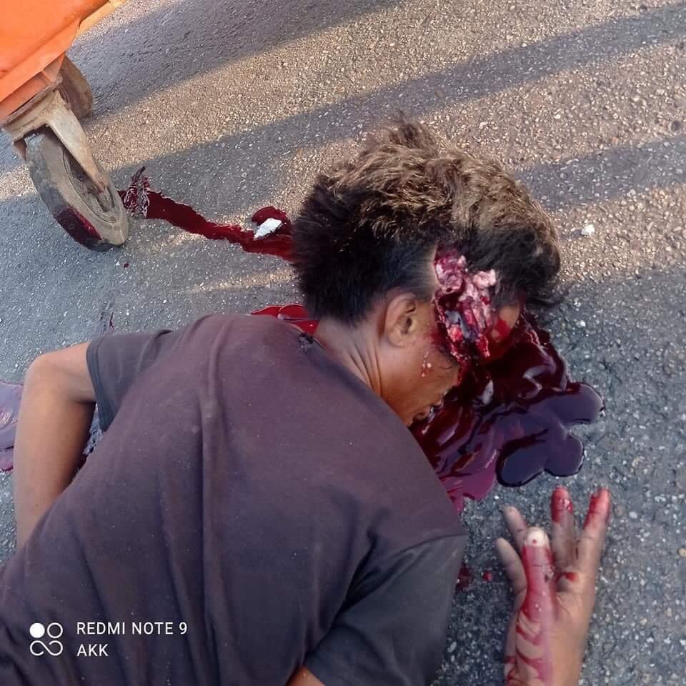 MarySengKham1's tweet photo. I ‘m heart breaking heart breaking 😩😩😭😭😭How Many death bodies does @UN needs to take Action?at least if you can’t help donate us safe vest and helmets for our protestors #Mar3Coup #NorthDagonMyanmar #WhatIsHappeningInMyanmar https://t.co/FkF0Ug90Bl