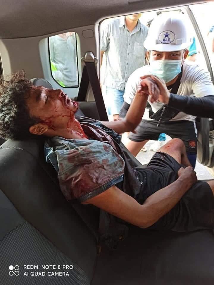 TW//Blood,Gunshots
Military Terrorists used machine gun .
Happening now in North Okkalapa ,Yangon ,Myanmar  🚨

<a href="/YourAnonCentral/">Anonymous</a> <a href="/UN_HRC/">UN Human Rights Council</a> <a href="/freya_cole/">Freya Cole</a> <a href="/UNinMyanmar/">United Nations in Myanmar</a> <a href="/YangheeLeeSKKU/">Yanghee Lee</a> <a href="/drsasa_mm/">Dr.Sasa-Supporter</a> <a href="/TostevinM/">Matthew Tostevin</a> <a href="/drsasa_mm/">Dr.Sasa-Supporter</a> <a href="/RapporteurUn/">UN Special Rapporteur Tom Andrews</a> <a href="/ICJ_Asia/">ICJ - Asia and the Pacific</a> <a href="/CIJ_ICJ/">CIJ_ICJ</a> 
 #WhatsHappeningInMyanmar
#Mar3Coup