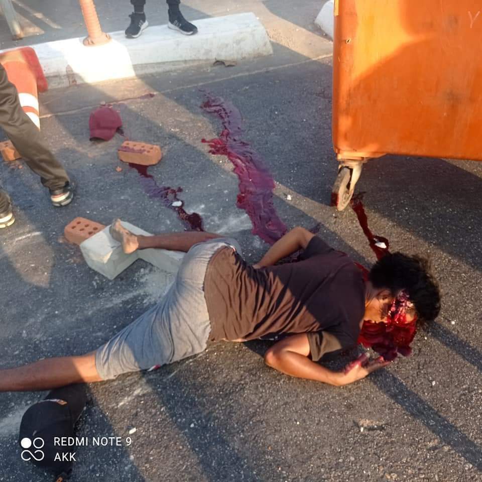 ThidaApril's tweet photo. Current situation in Myanmar is neither war zone nor battleground. It’s clearly a massacre, killing unarmed civilians intentionally by state-sponsored terrorists. Please save our human rights . Please save Myanmar. TW / / gun shot , blood

#March3coup
#SaveMyanmar https://t.co/PXoNzvPEj1