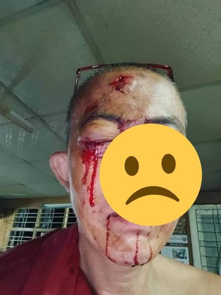 Even a monk who stood with citizens for justice got beaten by criminal terrorists.
tw // blood
#WhatsHappeningInMyanmar 
#Mar3Coup
<a href="/freya_cole/">Freya Cole</a> <a href="/RapporteurUn/">UN Special Rapporteur Tom Andrews</a>