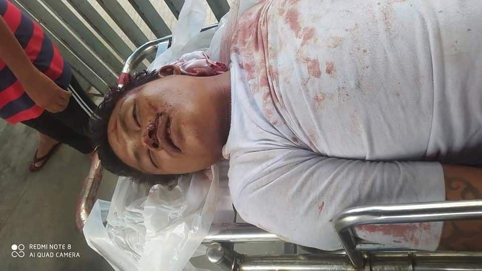 nslwin's tweet photo. GRAPHICS: 11 innocent civilians have been killed and over 50 injured in North Okkalapa, Yangon this evening. Two killed earlier in the same town. Total 13 in N. Okkalapa. #WhatsHappeninglnMyanmar #MilkTeaAlliance #Mar3Coup https://t.co/4dILozSVef