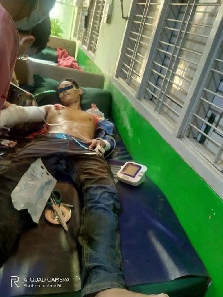 Hpakan, Myitkyina needs media help! There are lots of peaceful protestors injured both real guns and rubber guns including two are seriously injured by cruel terrorists. 

<a href="/UN/">United Nations</a>
<a href="/POTUS/">President Donald J. Trump</a>
<a href="/SchranerBurgen1/">Christine Schraner Burgener</a>
<a href="/RapporteurUn/">UN Special Rapporteur Tom Andrews</a>
<a href="/UNHumanRights/">UN Human Rights</a>
<a href="/CIJ_ICJ/">CIJ_ICJ</a>
<a href="/UN_HRC/">UN Human Rights Council</a>
#WhatsHappeningInMyanmar #Mar3Coup