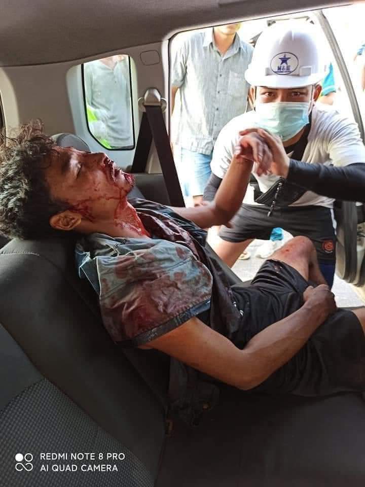 EXOBunny9's tweet photo. TW: VIOLENCE

#WhatsHappeningInMyanmar
#March3Coup 

We need the world's help💔 https://t.co/4JNIgYwUef