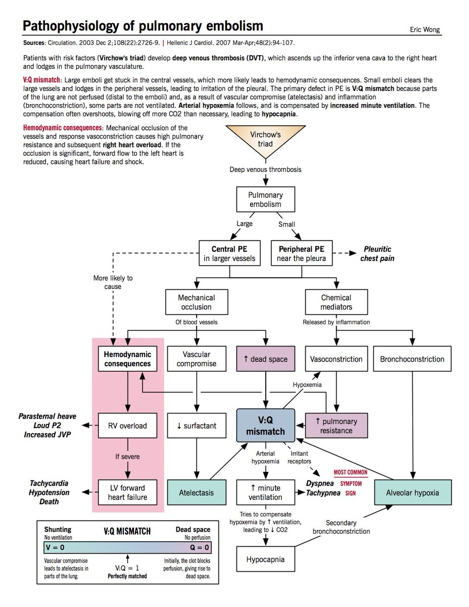 𝐏𝐚𝐭𝐡𝐨𝐩𝐡𝐲𝐬𝐢𝐨𝐥𝐨𝐠𝐲 𝐨𝐟 𝐏𝐮𝐥𝐦𝐨𝐧𝐚𝐫𝐲 𝐄𝐦𝐛𝐨𝐥𝐢𝐬𝐦 .
#medtwitter #meded #foamed #medstudenttwitter