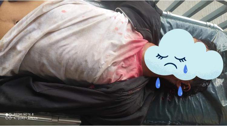 firelight794's tweet photo. TW // BLOOD
HappeningNorthOkkalapa : at least 2 dead on spot with headshots.#TERRORISTJUNTA used even machine-gun to kill civilians. @UN We need #R2P ASAP. 
#March3Coup 
#WhatsHappeninglnMyanmar 
@UN_HRC @freya_cole @SAdamsR2P @POTUS @SchranerBurgen1 @RapporteurUn https://t.co/j7Dea7lnf2