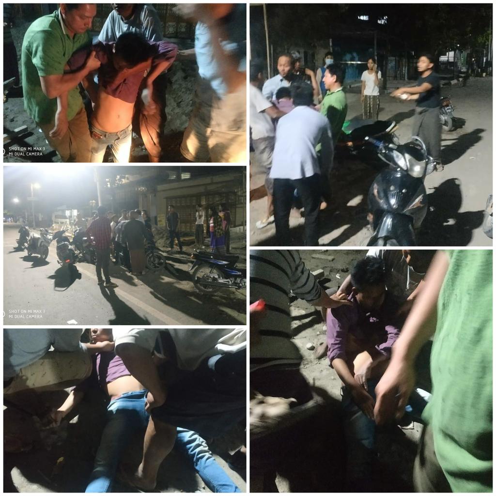 Lataut779's tweet photo. At 8PM in Kalay,Two young men riding motorcycles were violently beaten by the TERRORISTS on a passing Military vehicle without any reason at about 8PM.Both are seriously injured and one fainted from injured pains.
#WhatsHappeningInMyanmar
#Mar3Coup https://t.co/HSewzYxCbH