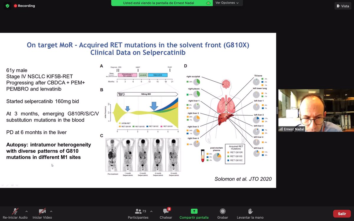 NReguart's tweet image. Seguimos en #CodingLungCancer con el Dr. Ernest Nadal @NadalErnest hablando de mecanismos de resistencia adquiridos a inhibidores de RET.