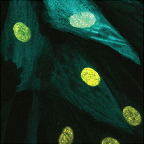 SamGhilardi's tweet photo. 1/ 8 Our lab's first preprint and my first paper thread, wherein we chase an unexpected microscopy observation and get to do some modeling (with @bio_MARK_er )and TEM imaging along the way. https://t.co/8m2hgfiRWE

It starts with this image of dermal myofibroblasts: https://t.co/B6zR57qmNf