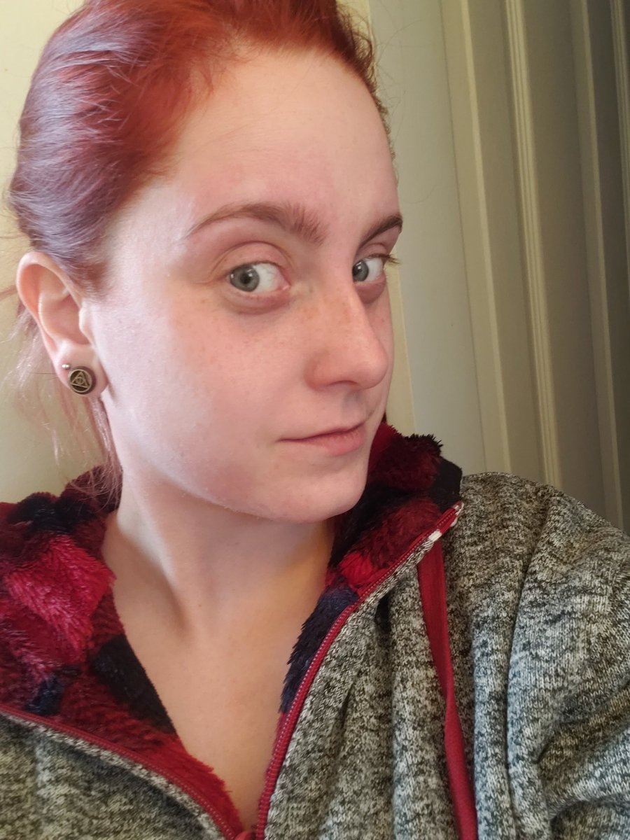 PurplePwnMe's tweet photo. My face feels so much better!!! https://t.co/r2x91KUyx6